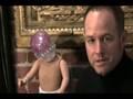 Shaken Baby Syndrome Lawyer, Christopher Keane, San Francisco, California, explains that Shaken Baby Syndrome can cause long term disabilities