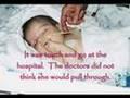 This baby was a victim of Shaken Baby Syndrome